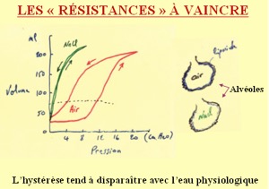 Qu'est-ce que la maladie des membranes hyalines ?