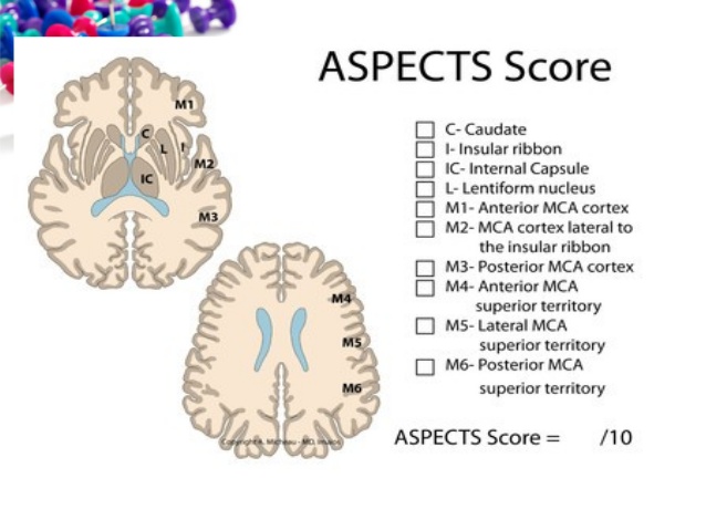 101-ct-neuroimaging-58-638