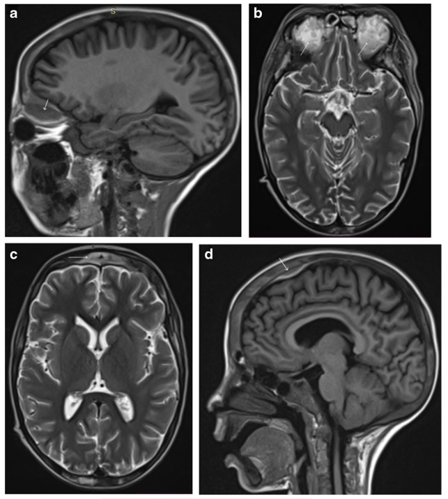 Capture d’écran 2025-11-16 à 11.17.45
