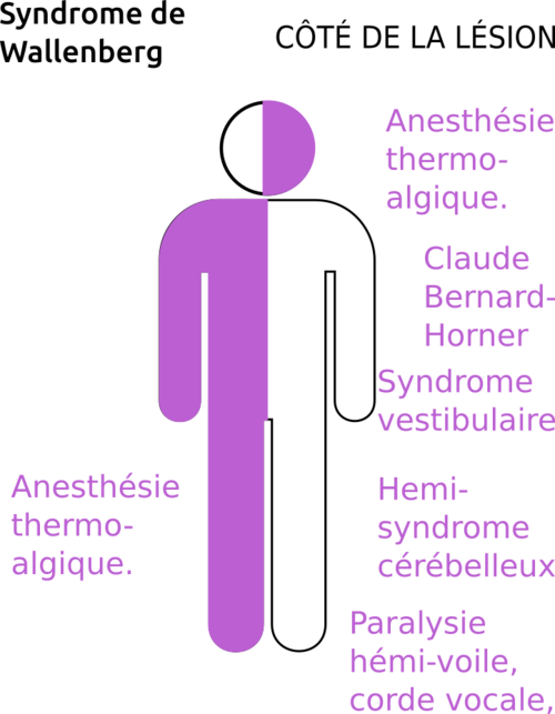 Stickerman_Wallenberg