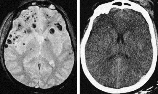 1-s2.0-S0750765805000924-gr1