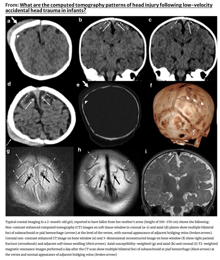 Capture d’écran 2025-10-12 à 12.15.42
