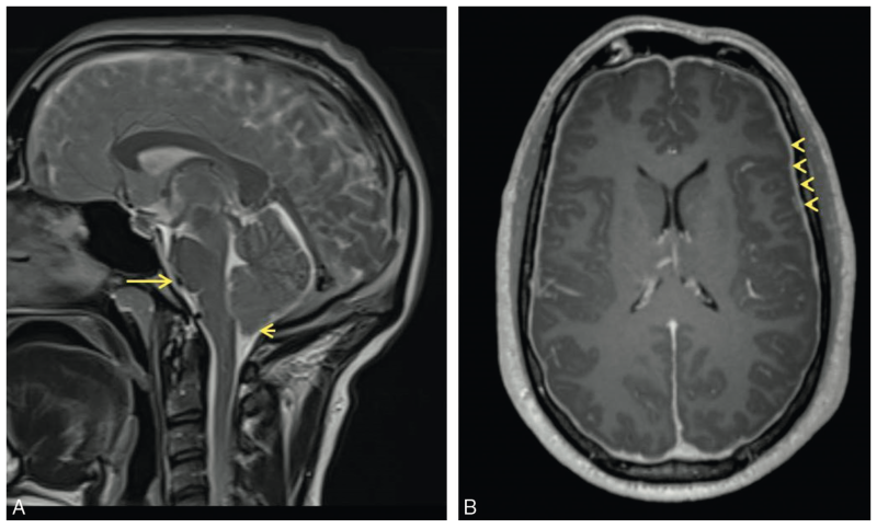 capture_decran_2021-12-28_a_09.56.07