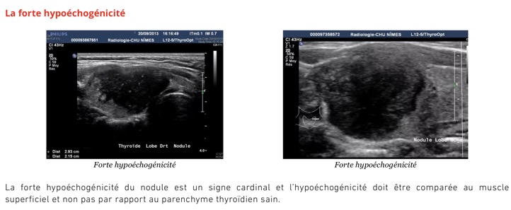 Capture d’écran 2025-11-08 à 10.24.18