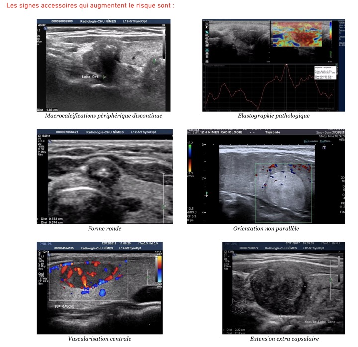Capture d’écran 2025-11-08 à 10.25.49