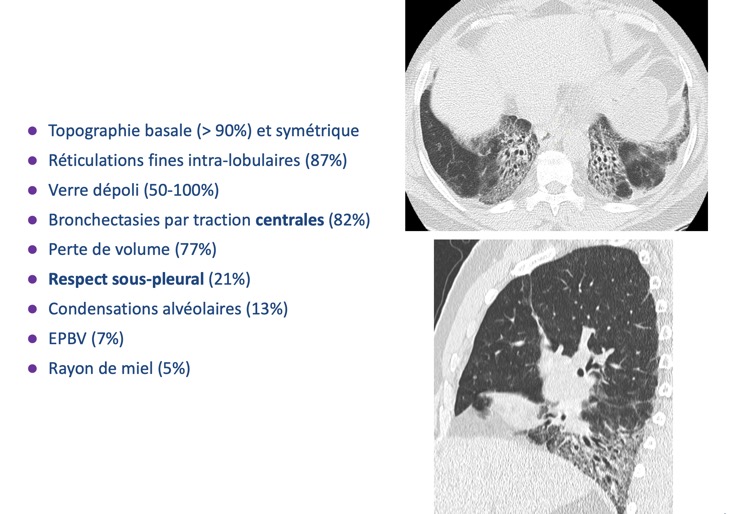 Capture d’écran 2026-02-22 à 09.08.58