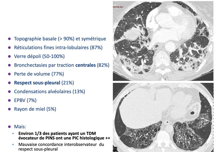 Capture d’écran 2026-02-22 à 09.09.30