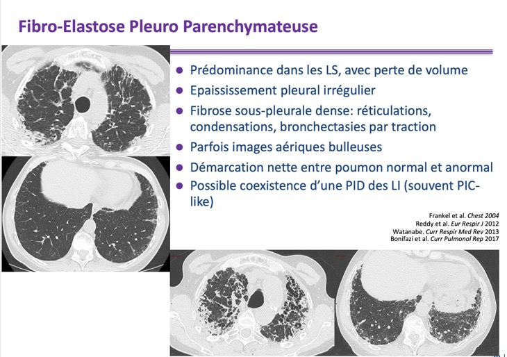 Capture d’écran 2026-02-22 à 09.10.53