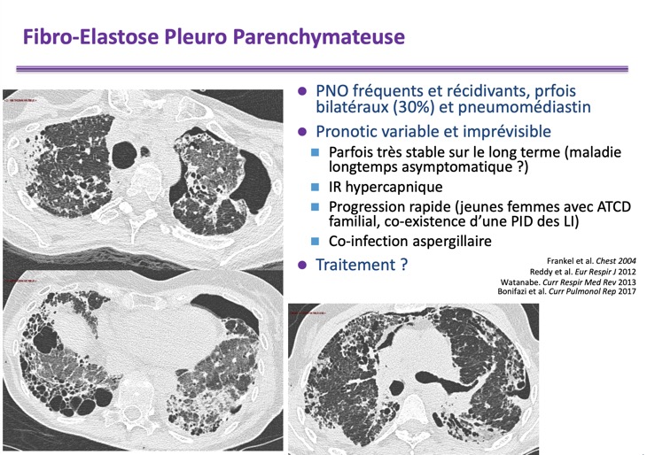 Capture d’écran 2026-02-22 à 09.11.05