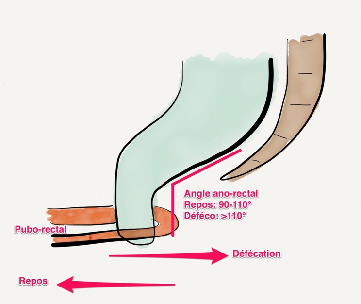 angle-puborectal
