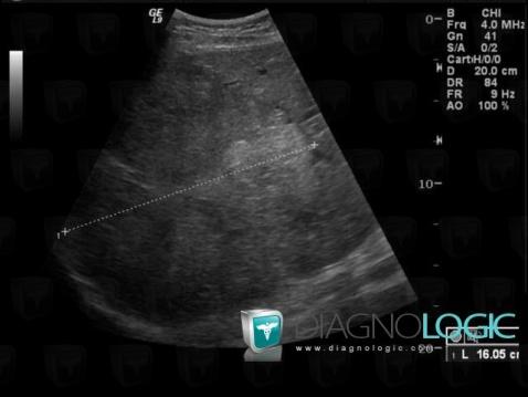 echographie-1390-33311bbab746fbb-478