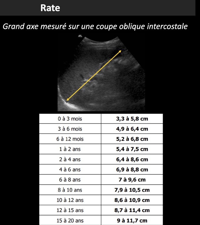 Capture d’écran 2025-05-26 à 08.39.25