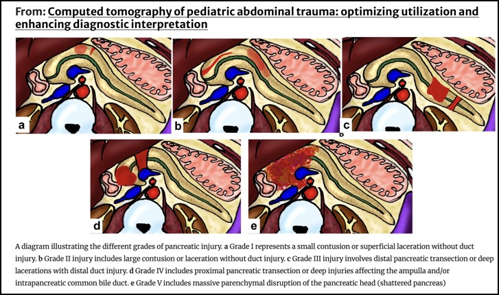 Capture d’écran 2025-10-12 à 12.07.25