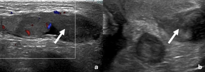 Capture d’écran 2025-10-22 à 12.18.09
