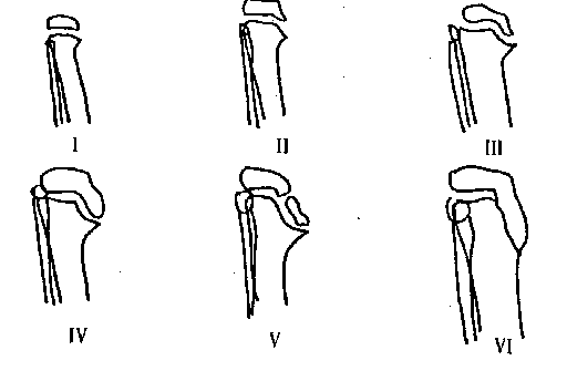 15_ORTHOP_DIE_COURANTE3
