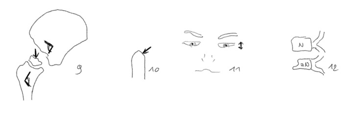 675A9A2F-45AB-4699-B36B-686FA600AB4B_1_201_a