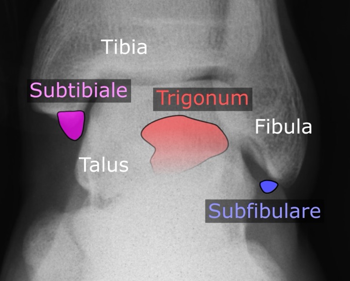 Accessory_bones_of_the_ankle