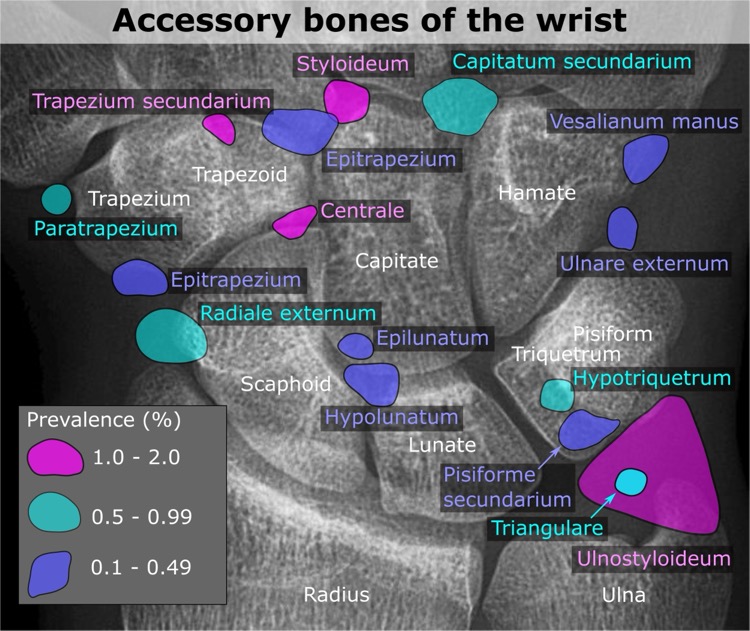 Accessory_bones_of_the_wrist