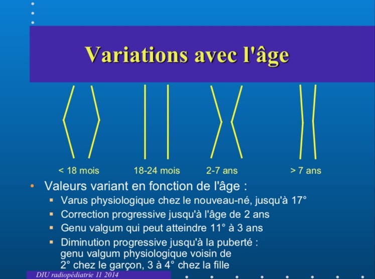 angle fémoro-tibial