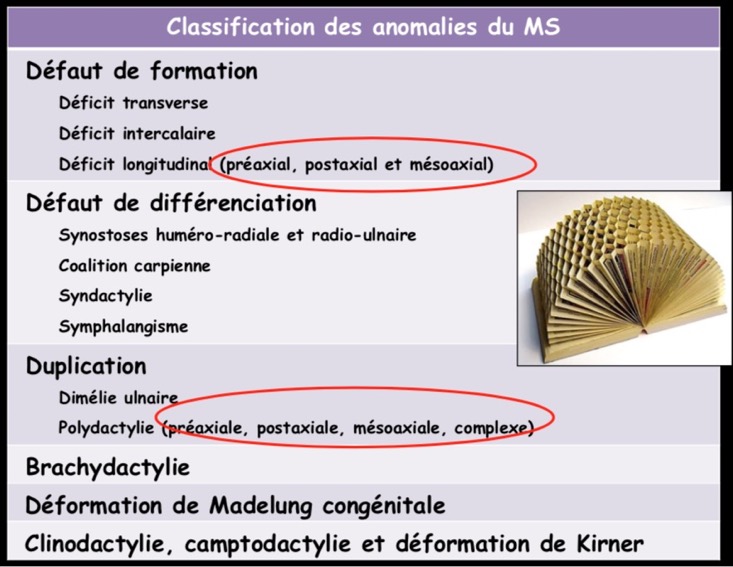 Classification des anomalies du MS