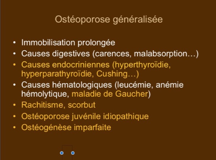 Ostéoporose généralisée