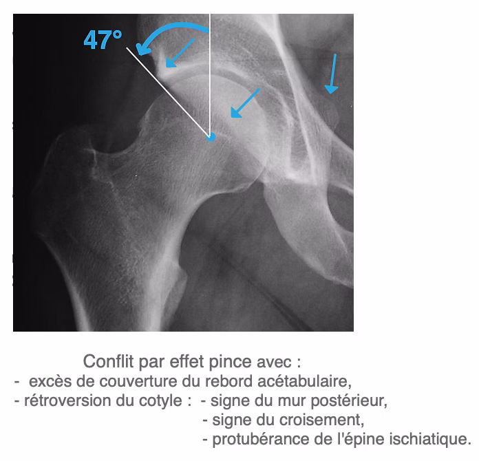 Capture d’écran 2022-02-19 à 17_17_52.png