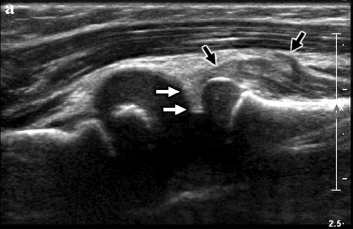Capture d’écran 2026-02-22 à 08.37.33