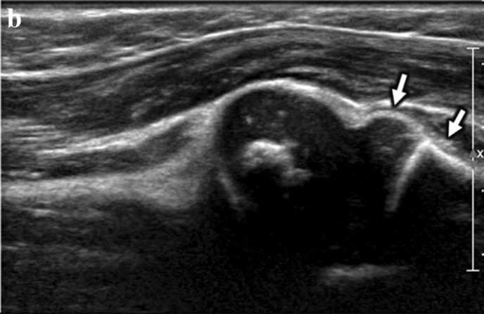 Capture d’écran 2026-02-22 à 08.37.39