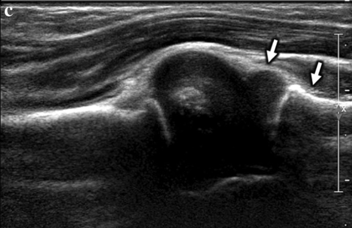 Capture d’écran 2026-02-22 à 08.37.48