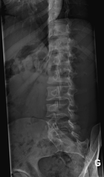 oblique2