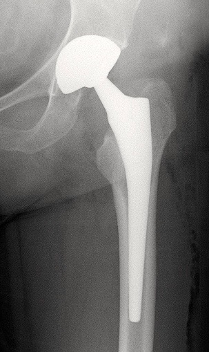 radio-pth-double-mobilite