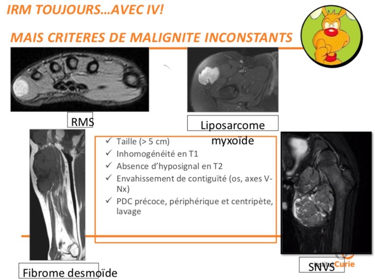 Lésions des t. mous3