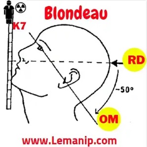 blondeau
