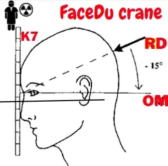 Face du crane