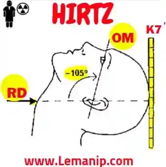Hirtz