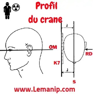 Profil du crane