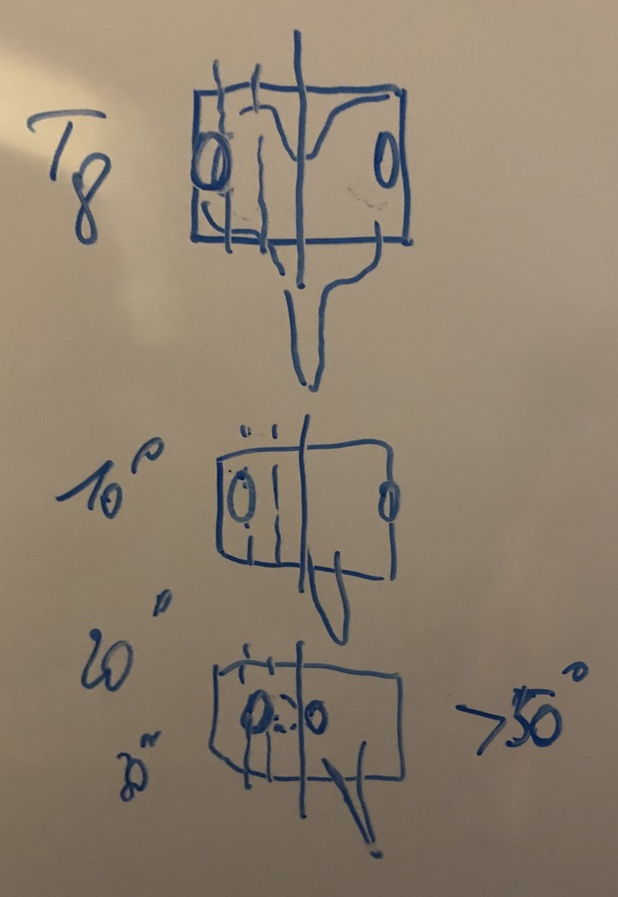 rotation vertebre